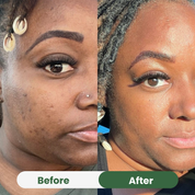 Oil of Oregano with Black Seed Oil — Skin Clarity Formula