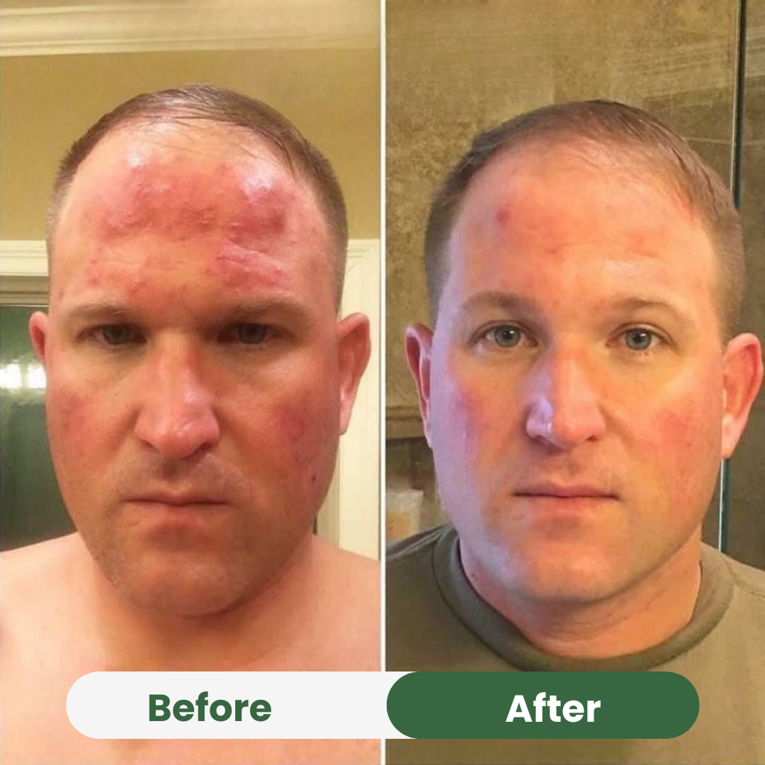 Oil of Oregano with Black Seed Oil (6,000mg)