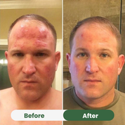 Oil of Oregano with Black Seed Oil (6,000mg)